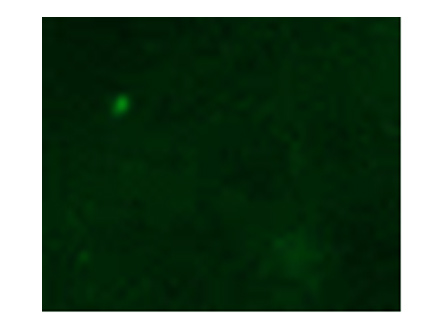 Fluorescent immunostaining of xenograft cancer tissue of a model mouse