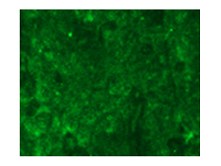 Fluorescent immunostaining of xenograft cancer tissue of a model mouse